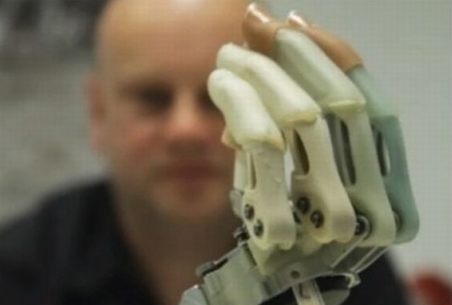 Бионический протез руки вернул человеку чувство такта