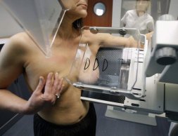 Влияет ли маммография на смертность от рака груди?