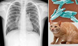 первый случая заражения человека туберкулезом от кошки