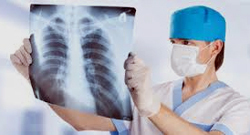 смертность от туберкулёза