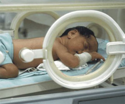 смертность от преждевременных родов