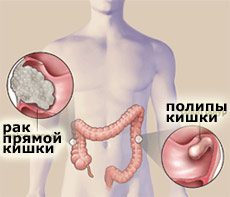 диета no5 рецепты салатов или диета советы диетологов