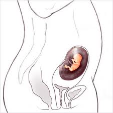 Шеечная беременность, полипы цервикального канала, рак шейки матки