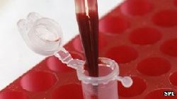 анализ крови ребенка, эритроциты, гемоглобин