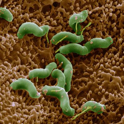 бактерии Helicobacter pylori, Хронический гастрит