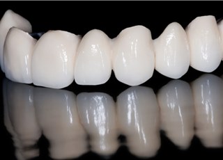 Коронки из диоксида циркония: эталон современной стоматологии
